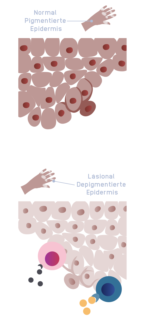 Complex_Disease_Mobile