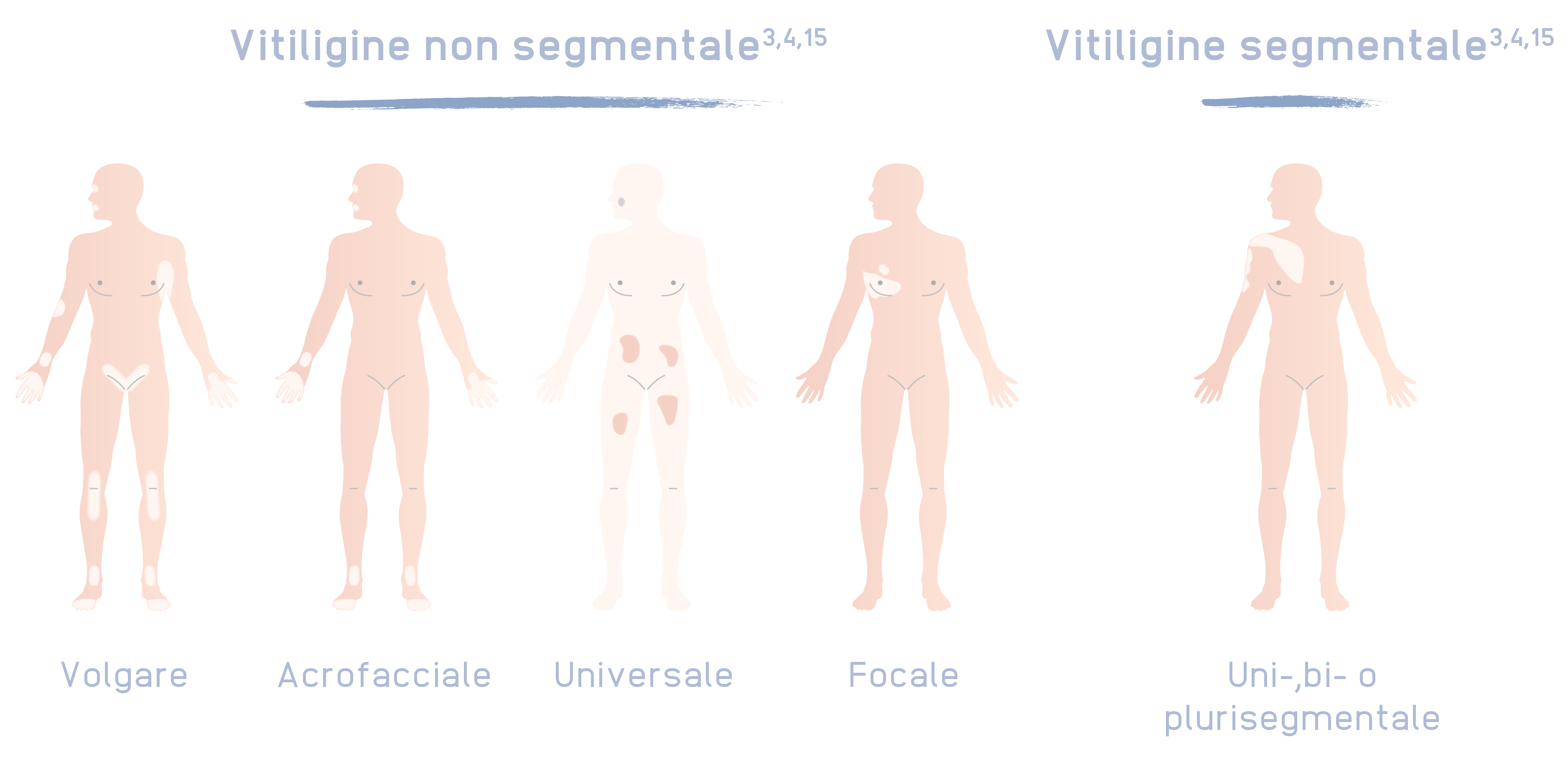 INT2213_Inctye_Vitiligo_Website_Graphics_Italian_R1V3_Non-Segmental_Desktop.png