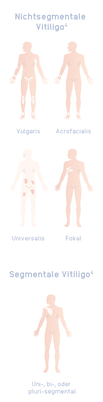 INT2106_Inctye_Vitiligo_Website_Graphics_German_R1V6_Non-Segmental_Mobile