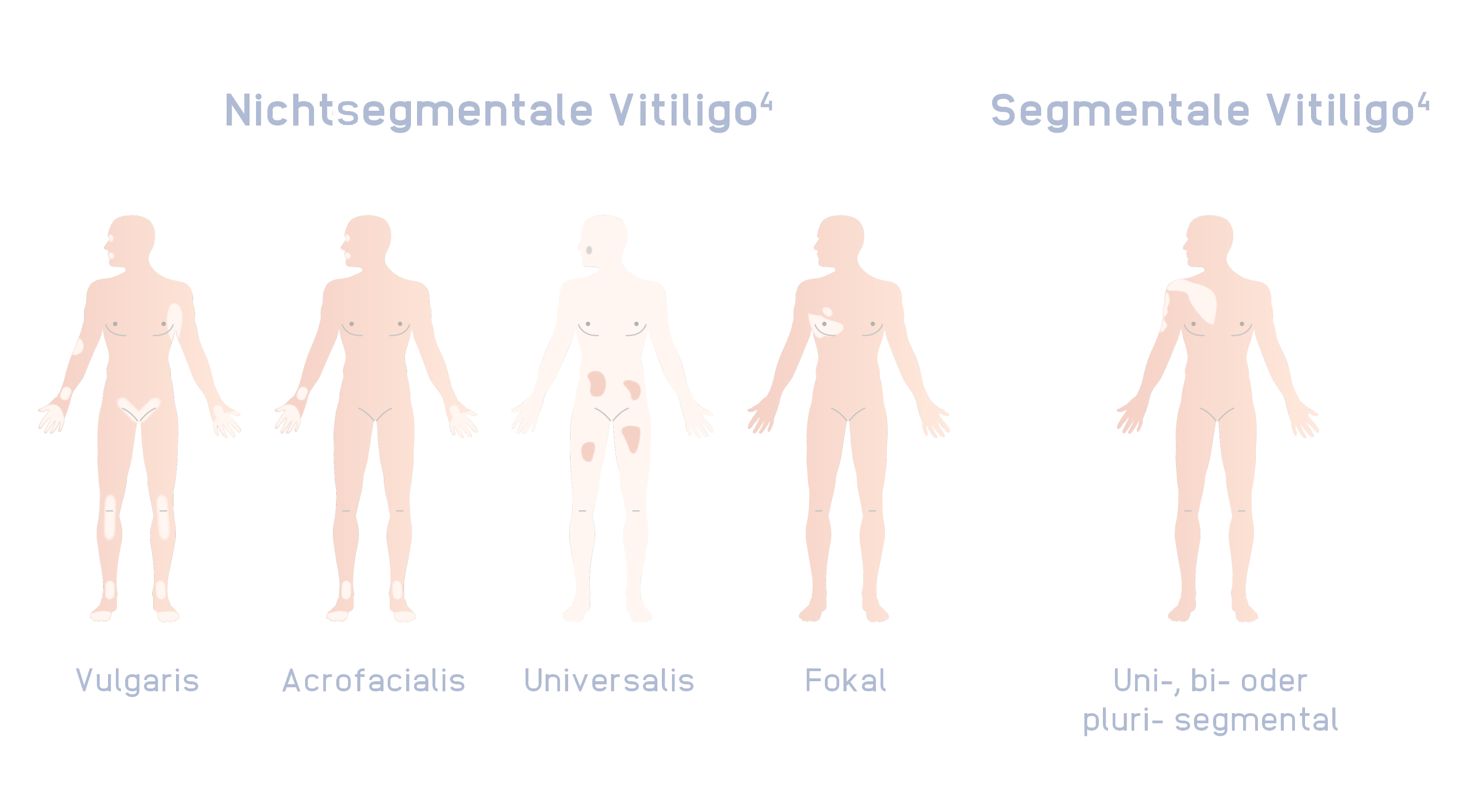 Inctye_Vitiligo_Website_Graphics_German_R1V6_Non-Segmental_Desktop