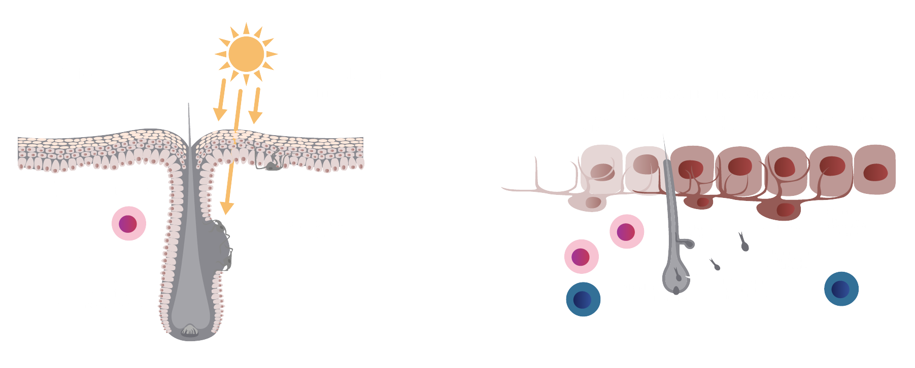 INT2106_Inctye_Vitiligo_Website_Graphics_R2V2-es-ES_Interventions_And_Repigmentation_Desktop